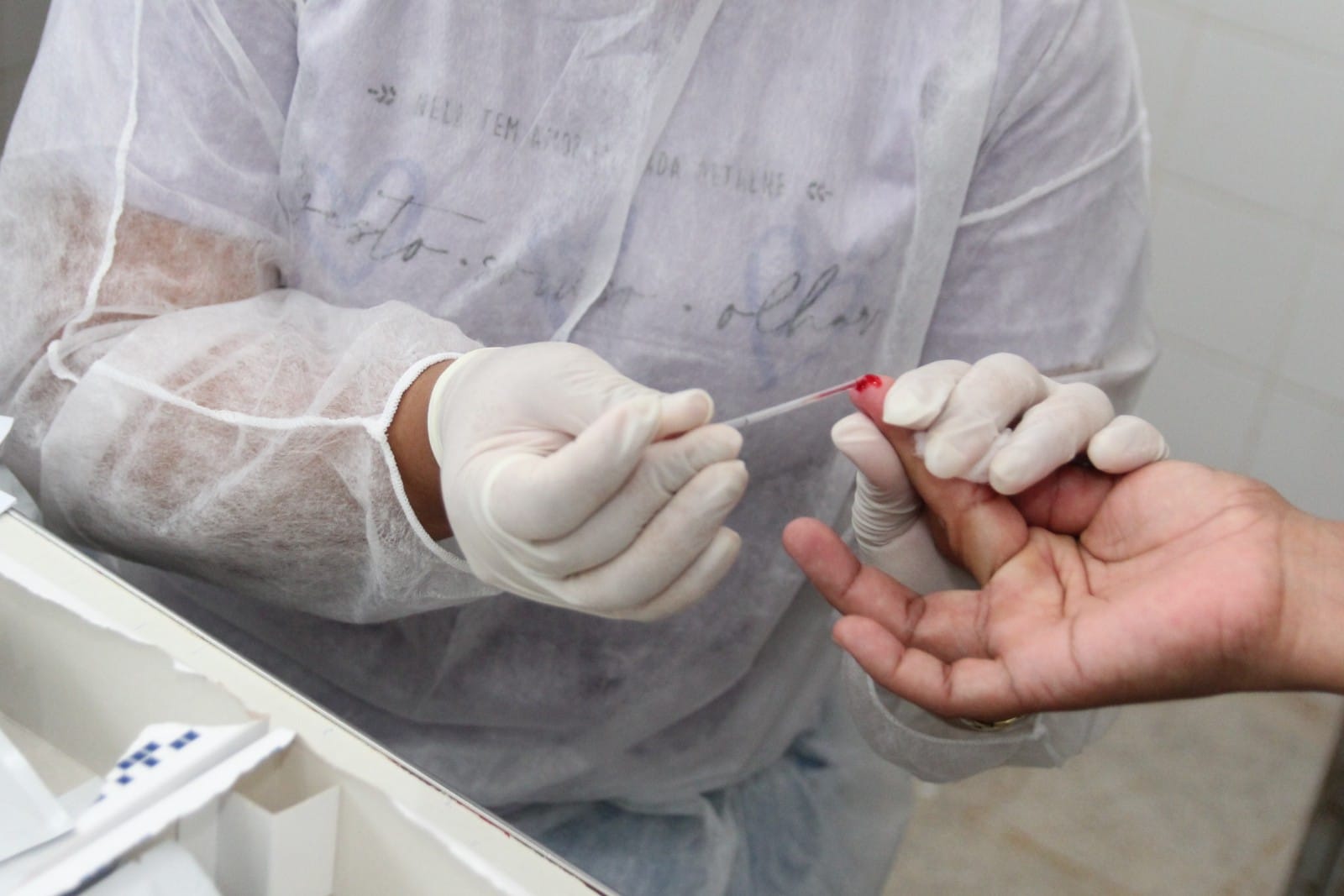 Julho Amarelo: Prefeitura de Coruripe realiza ações no mês de luta contra as hepatites virais